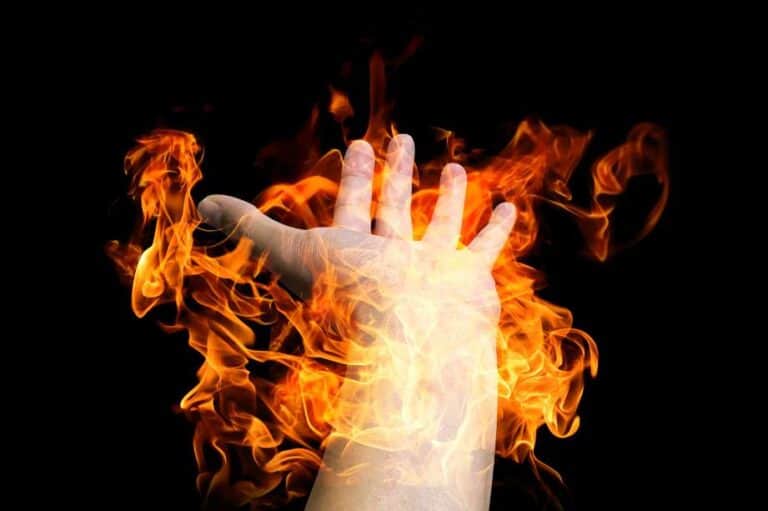 burn injury lawyer