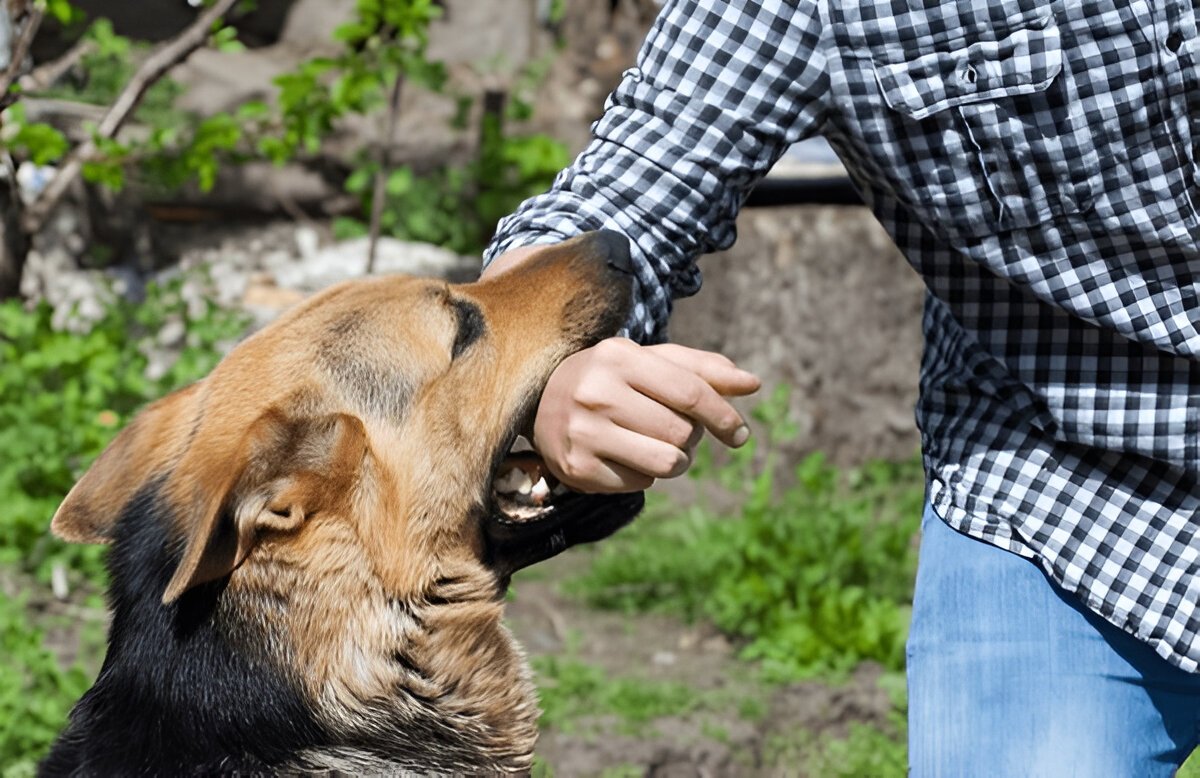 Columbia dog bite injury lawyers