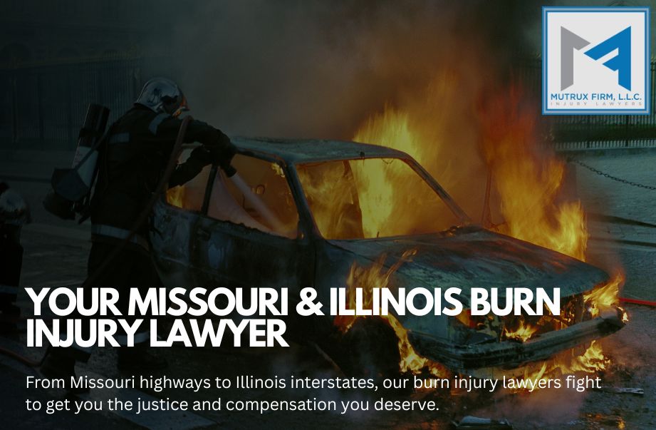 burn injury lawyer