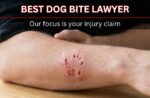 best dog bite lawyer in st. louis