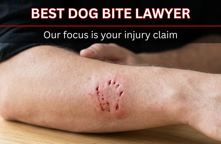 The 10 Best Dog Bite Lawyers in St. Louis