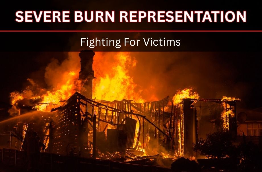 st. louis burn injury lawyer